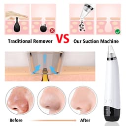 Kasvojen puhdistusaine tyhjiöllä Valkoinen / musta - Poistaa mustapäitä