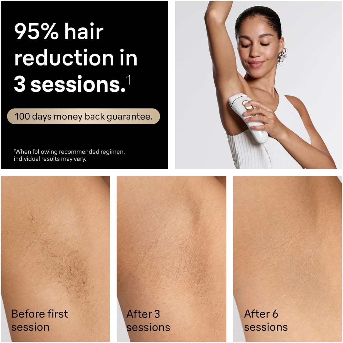Braun IPL Silk·expert Pro 5 PL5431 – tuotekuva 4