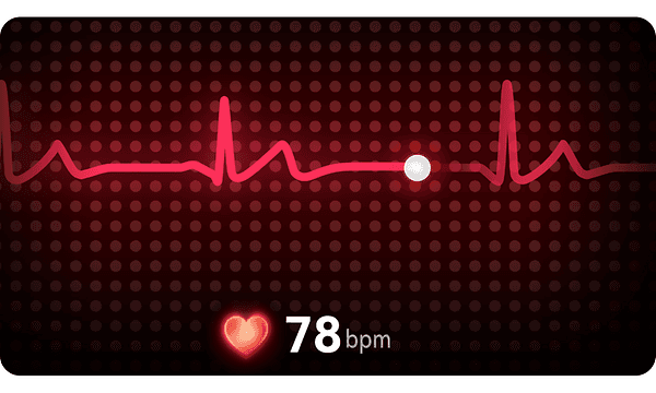EKG