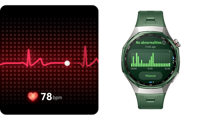 ECG and HUAWEI WATCH GT 7 Pro